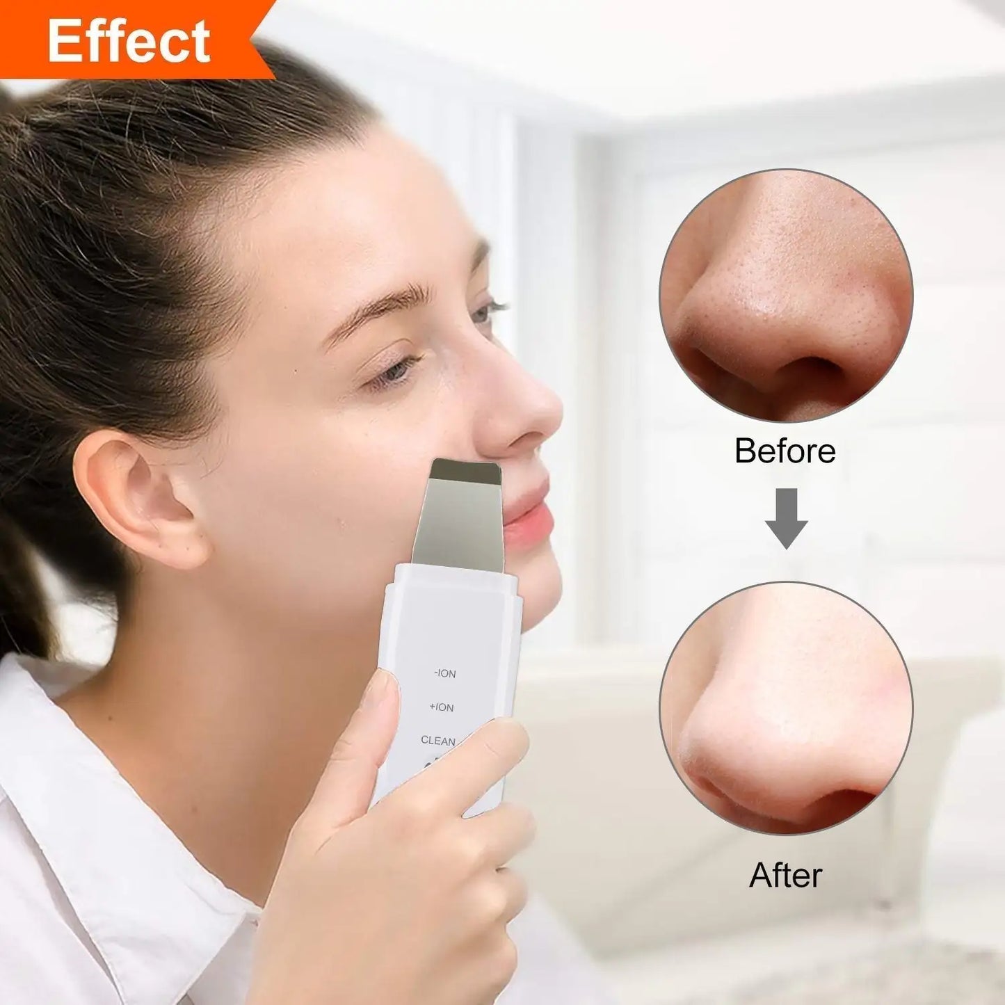 Ultrasonic Skin Scrubber - MyRTouch